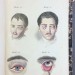 Офтальмология. Монография глазной болезни, 1839 год.